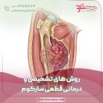 روش‌ های تشخیصی و درمانی قطعی سارکوم