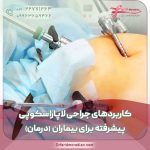کاربردهای جراحی لاپاراسکوپی پیشرفته برای بیماران (درمان)