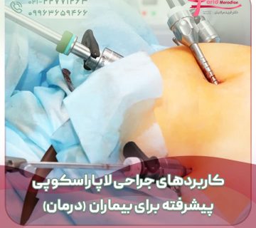 کاربردهای جراحی لاپاراسکوپی پیشرفته برای بیماران (درمان)