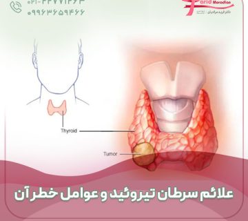 علائم سرطان تیروئید و عوامل خطر آن