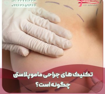 تکنیک های جراحی ماموپلاستی چگونه است؟